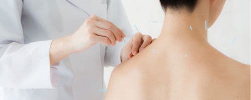 Crescimento de Carreira em Acupuntura: Trazendo Equilíbrio e Bem-Estar