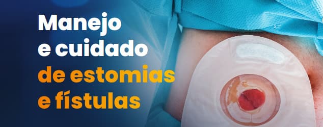 Conheça o ebook sobre manejo e cuidado de pacientes com estomias e fístulas
