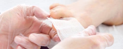 Técnicas Avançadas de Curativos Podiátricos: Inovações na Enfermagem